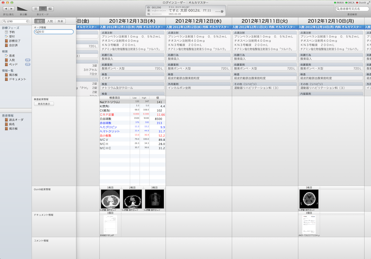 iMiRiX日別、時系列表示