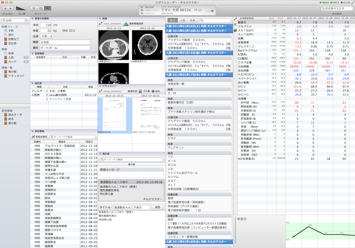 iMiRiX最新、時系列表示